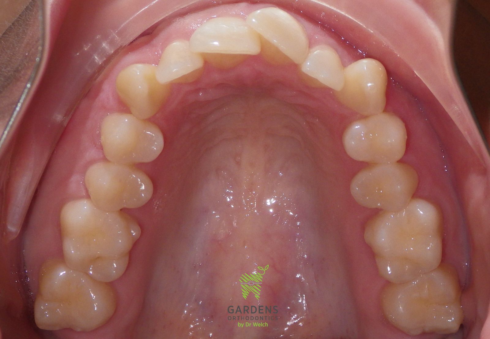 Airway Orthodontics