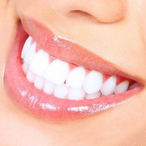 GLO™ Teeth Whitening in Palm Beach Gardens, FL
